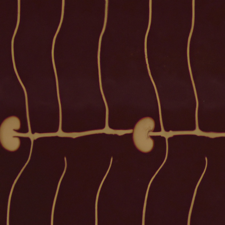 Correlation of Kidney Tubular Indicators with Onset Macroalbuminuria and Consistent Low eGFR in DCCT/EDIC Studies